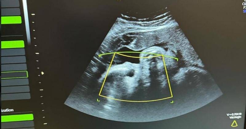 Instagram.com/aurelie.hermansyah